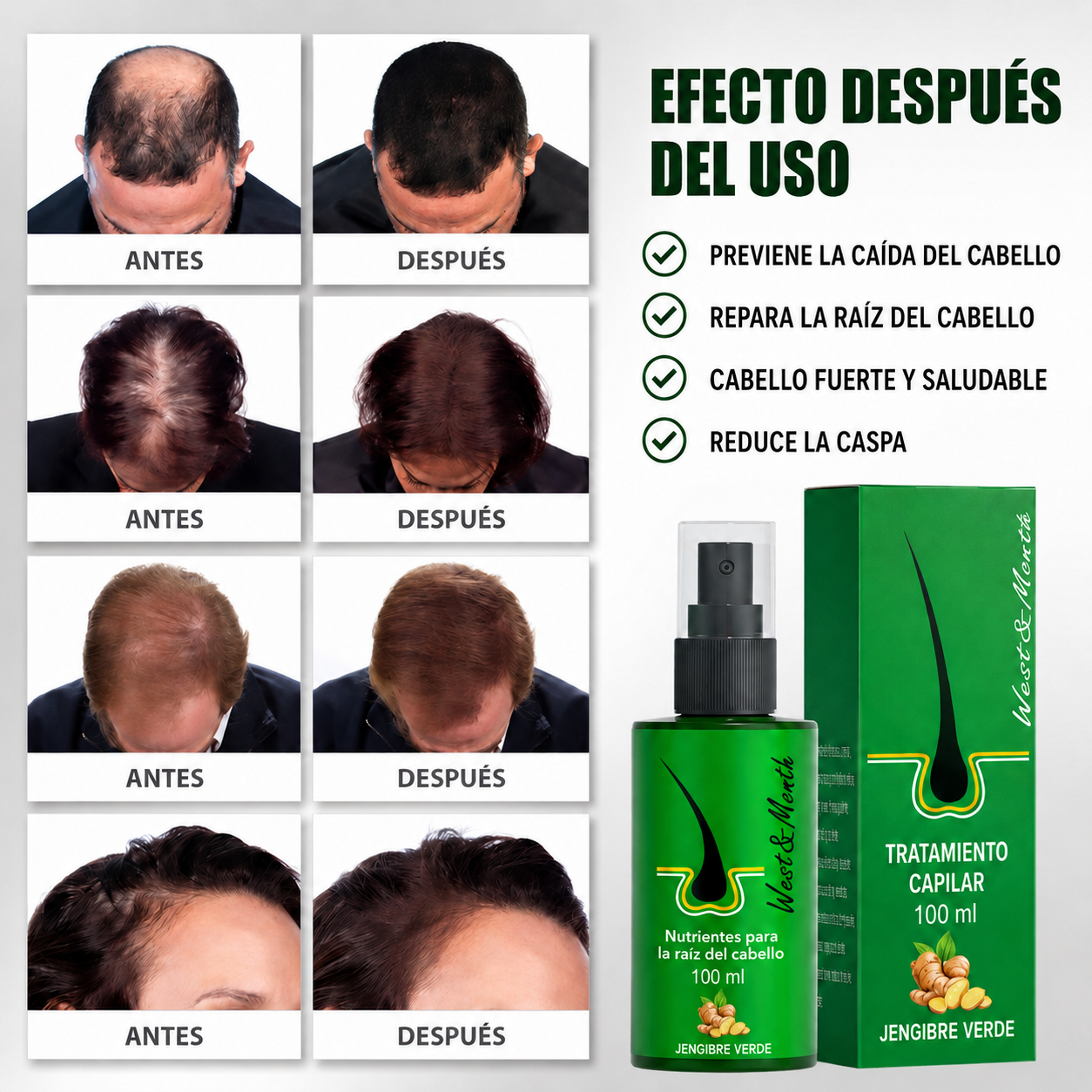 Pack de 2 Spray de Crecimiento del Cabello 100ml Green Ginger