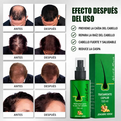 Pack de 2 Spray de Crecimiento del Cabello 100ml Green Ginger