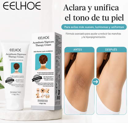 Pack de 2 Crema Aclarante Blanqueadora 50g - Eelhoe